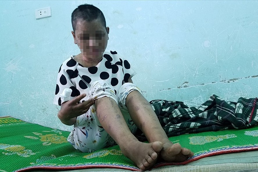 Bộ LĐTBXH đề nghị tỉnh Gia Lai xử lý nghiêm vụ bạo hành người làm công