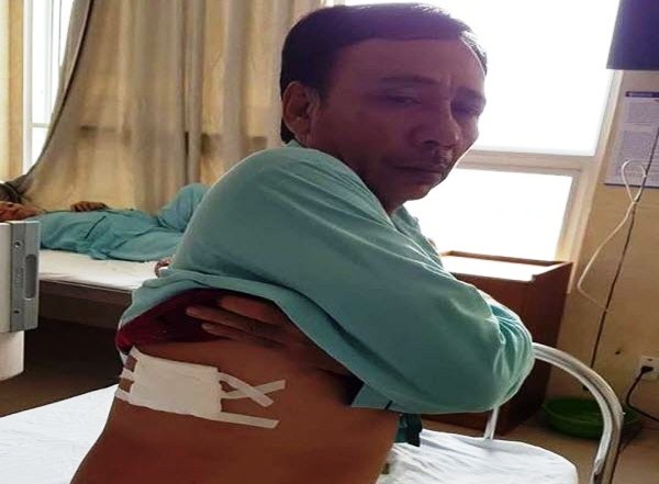 2 “hiệp sĩ” truy bắt trộm bị đâm trọng thương