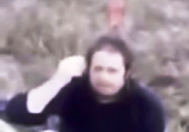 Người đàn ông cắm thẳng con dao 20 cm vào sọ để… dễ thở