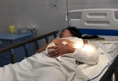 Chuyện chưa kể về kỳ tích nối cánh tay đứt lìa cho nữ sinh viên bị tai nạn trên đèo Hải Vân