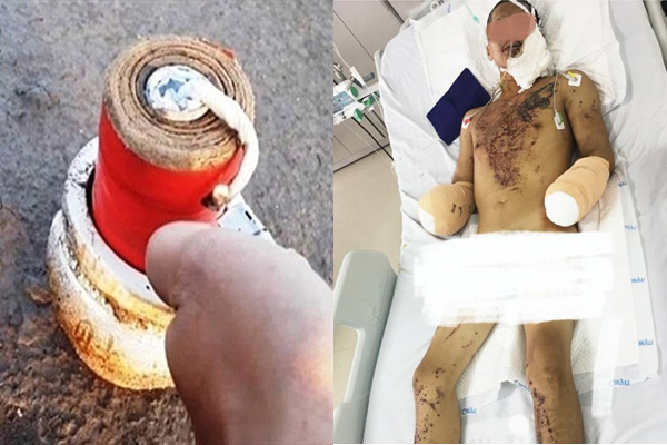 Công an Hải Phòng thông tin chính thức về vụ nổ bí ẩn làm nam thanh niên cụt hai tay