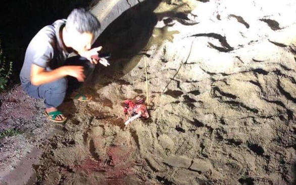 NÓNG Bé trai 7 tuổi bị đàn chó tấn công đã tử vong