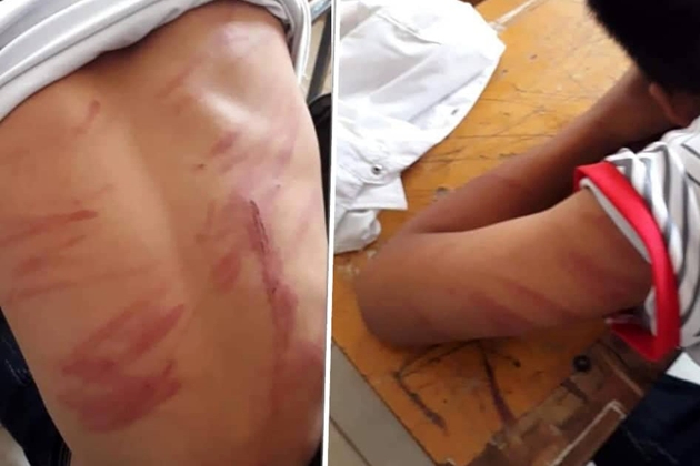 Nam sinh lớp 8 lên lớp ngất xỉu vì bị bố đẻ đánh đập