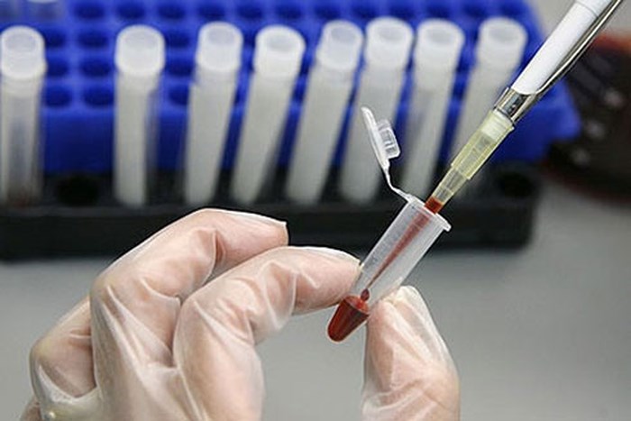 Hình phạt cho tội truyền HIV cho người khác