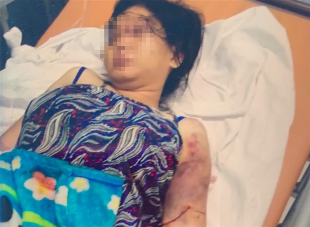 Khởi tố kẻ nhốt, tra tấn thiếu nữ 18 tuổi đến sẩy thai