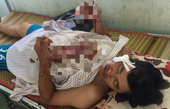 Phê chuẩn khởi tố, bắt tạm giam đối tượng chém Xã đội trưởng rách mặt