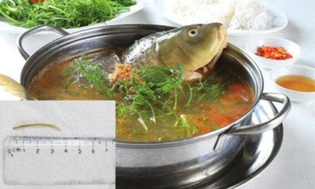 Người phụ nữ bị thủng ruột non sau khi ăn lẩu cá