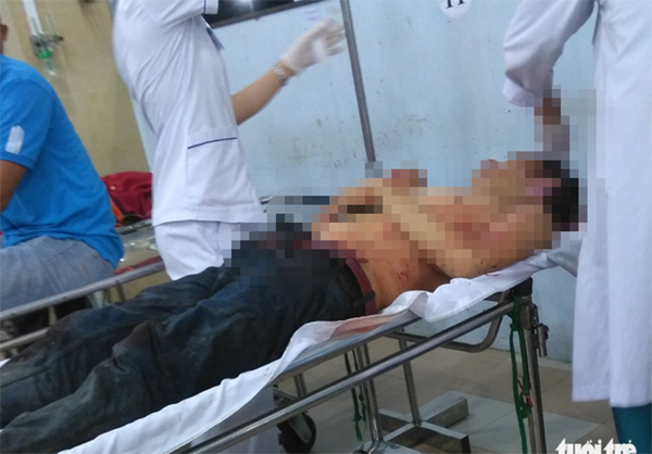 Xưng hùng xưng bá giữa đường bị chém suýt chết