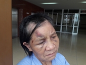 Công an vào cuộc vụ cháu trói tay, đánh bà ngoại gãy 5 xương sườn ở Quảng Ninh