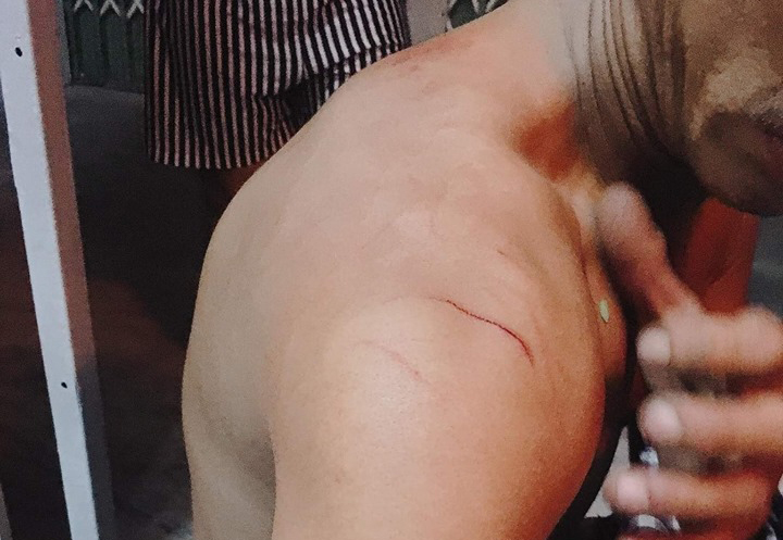 Xuất hiện nhóm đối tượng dùng kim tiêm  “xin đểu” và hành hung người đi đường