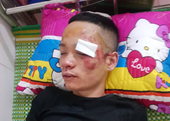 Hai thanh niên vô cớ bị nhóm đối tượng đánh nhập viện ở Nga Sơn