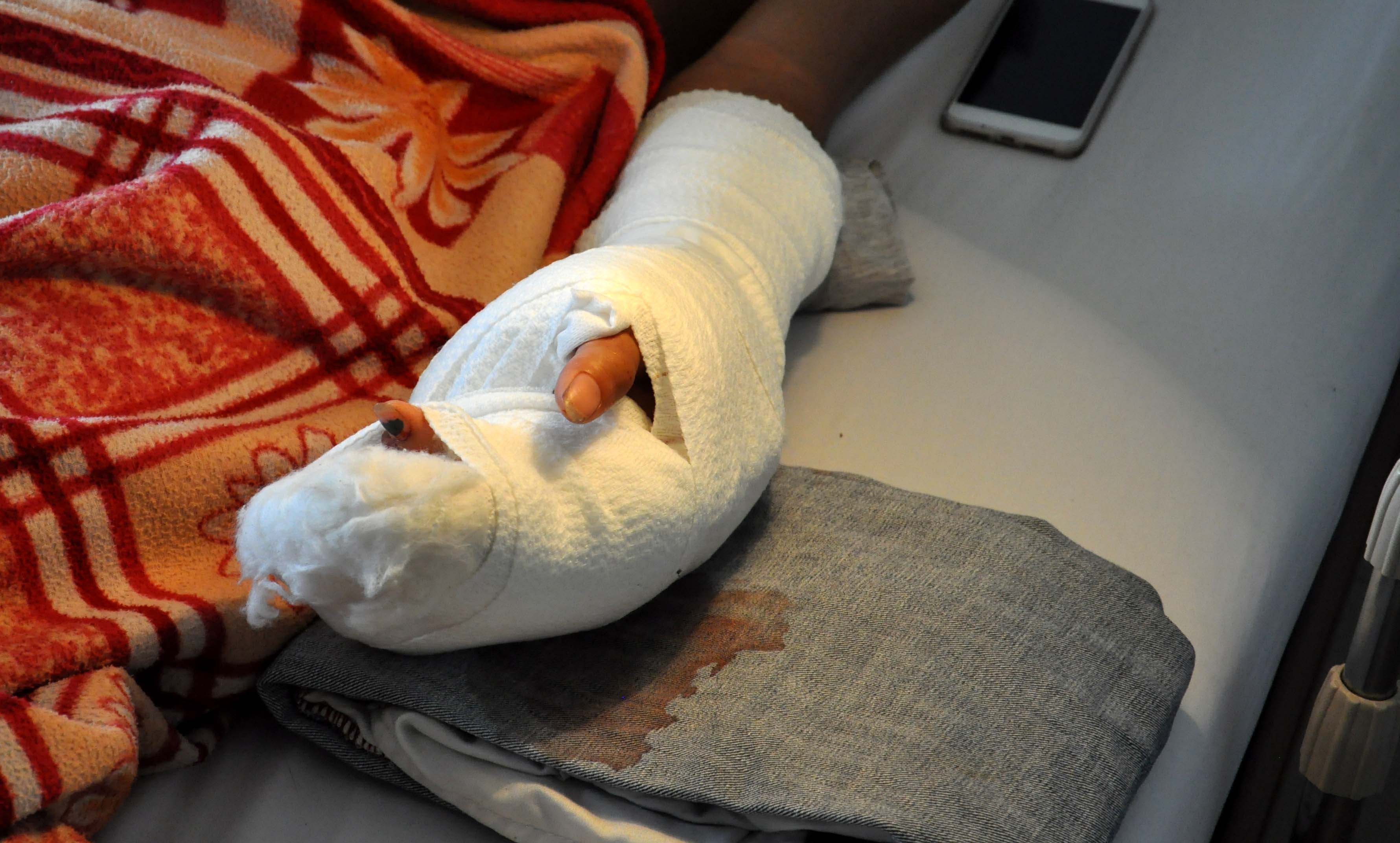 Lời kể đau lòng của cô giáo bị chồng cũ chém gần đứt lìa 2 bàn tay