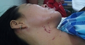 Lời khai trong nước mắt của người vợ bị chồng bạo hành, dìm xuống bể bơi ở Tây Ninh