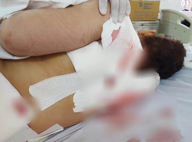 Vợ bị chồng chém tới tấp vì đưa bạn trai lạ mặt về nhà