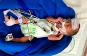 Tìm người thân cho bé sơ sinh sinh non tử vong tại bệnh viện