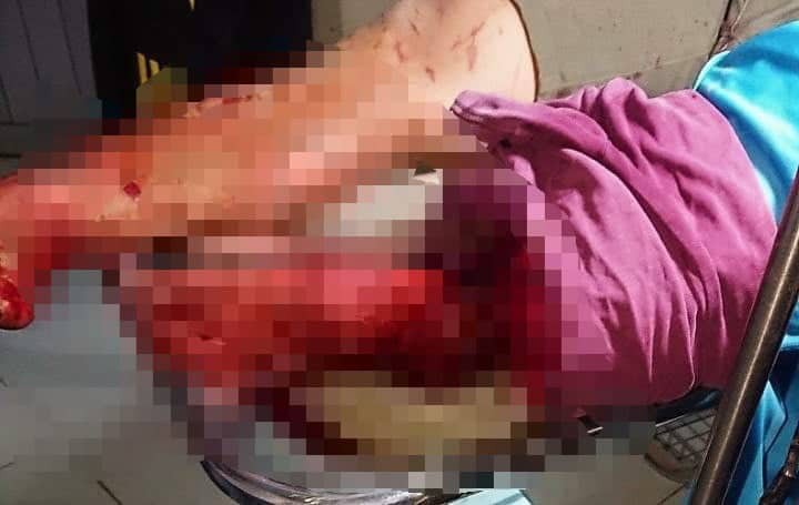 Bị chém tơi bời sau va chạm giao thông với cặp vợ chồng câm điếc