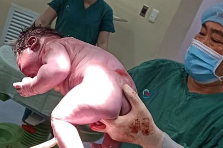 Bé trai khổng lồ chào đời khỏe mạnh bằng phương pháp sinh mổ