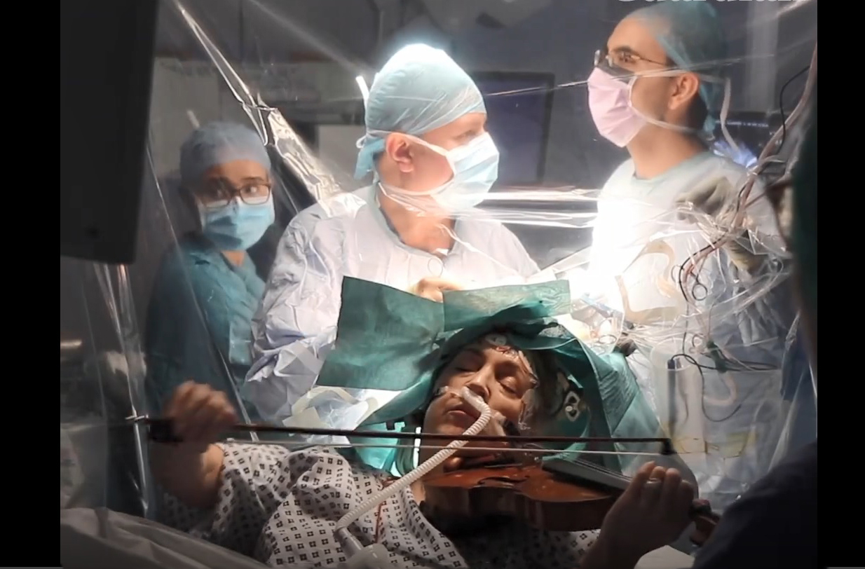 Kỳ lạ bệnh nhân chơi violin trong khi mổ não