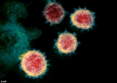 Mỹ tuyên bố đã tạo được vắc-xin coronavirus,
