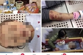 Khởi tố vụ án bạo hành dã man khiến bé gái 3 tuổi tử vong ở Hà Nội