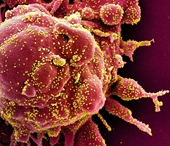 Úc phát hiện loại thuốc chống ký sinh trùng có thể tiêu diệt coronavirus