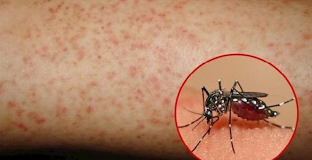 Sốt xuất huyết khó ngăn chặn nếu người dân còn chủ quan