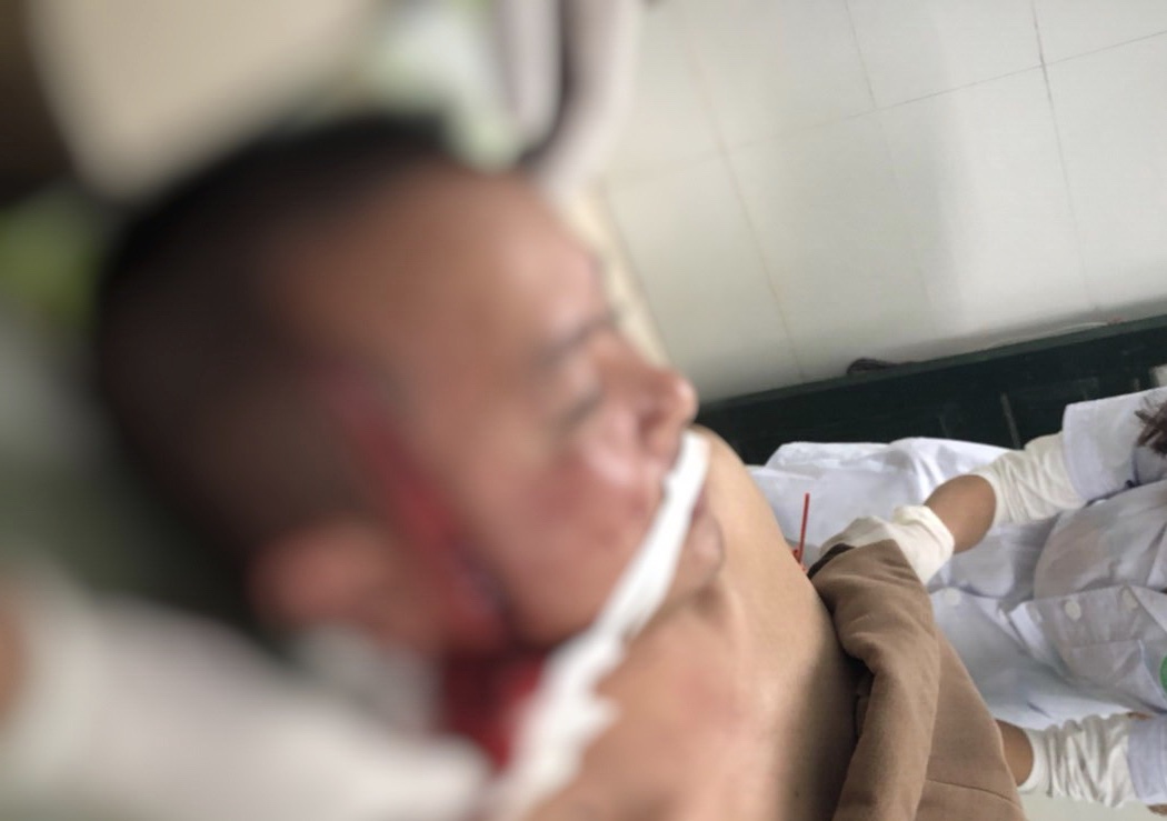 Đi hát Karaoke   bỗng dưng bị chém rồi bị dân xăm trổ vào tận bệnh viện dọa giết