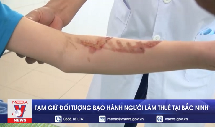 Tạm giữ đối tượng bạo hành người làm thuê tại Bắc Ninh