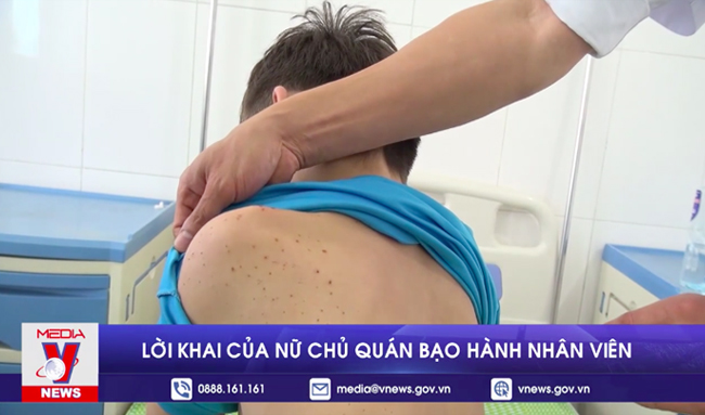 Lời khai của nữ chủ quán bạo hành nhân viên
