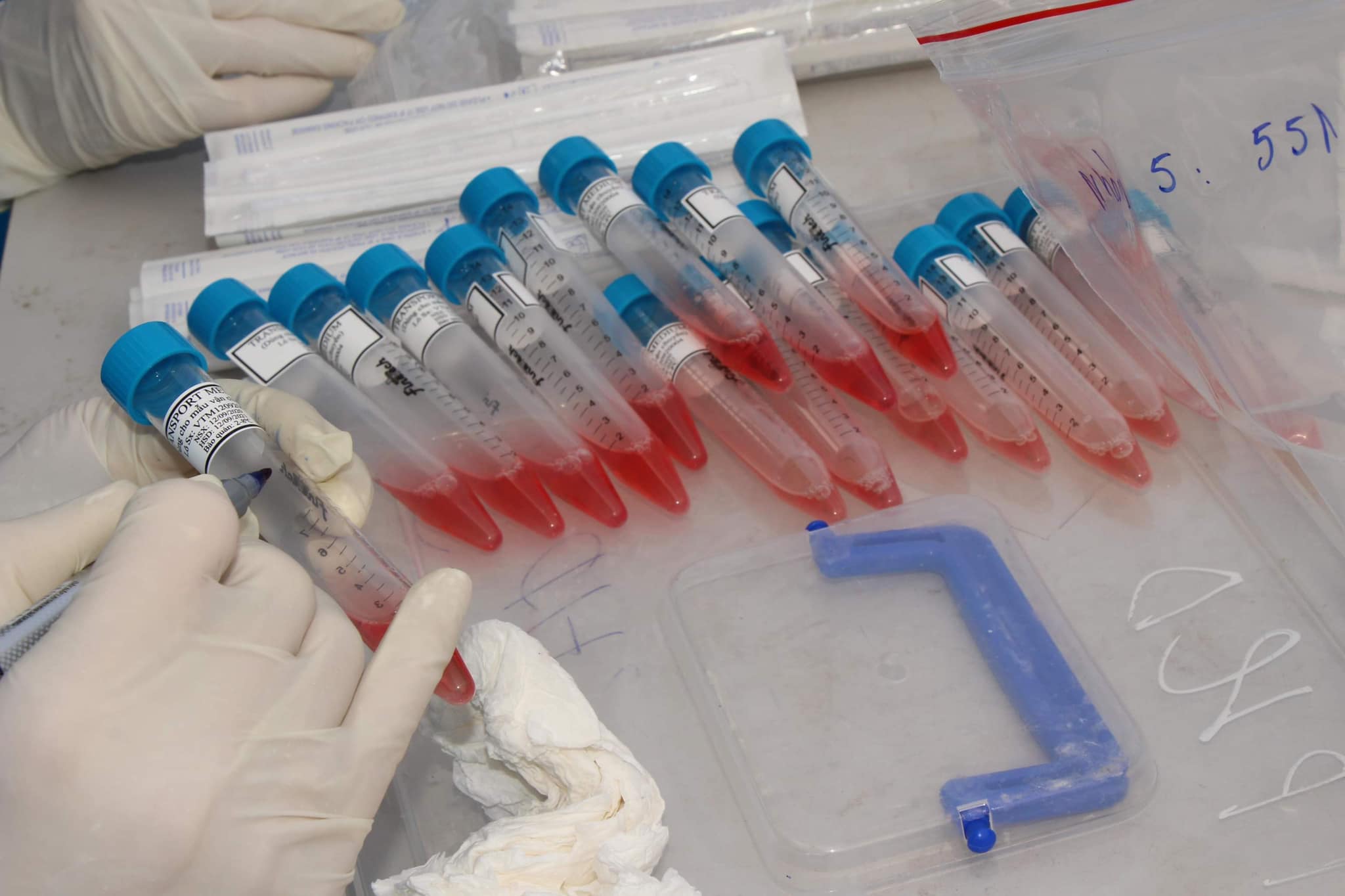 Sáng 5 2, Việt Nam không có ca nhiễm COVID-19