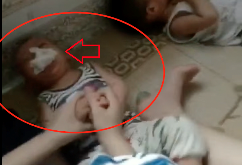 Bộ GD ĐT yêu cầu xử lý nghiêm vụ nhét giẻ vào miệng trẻ mầm non