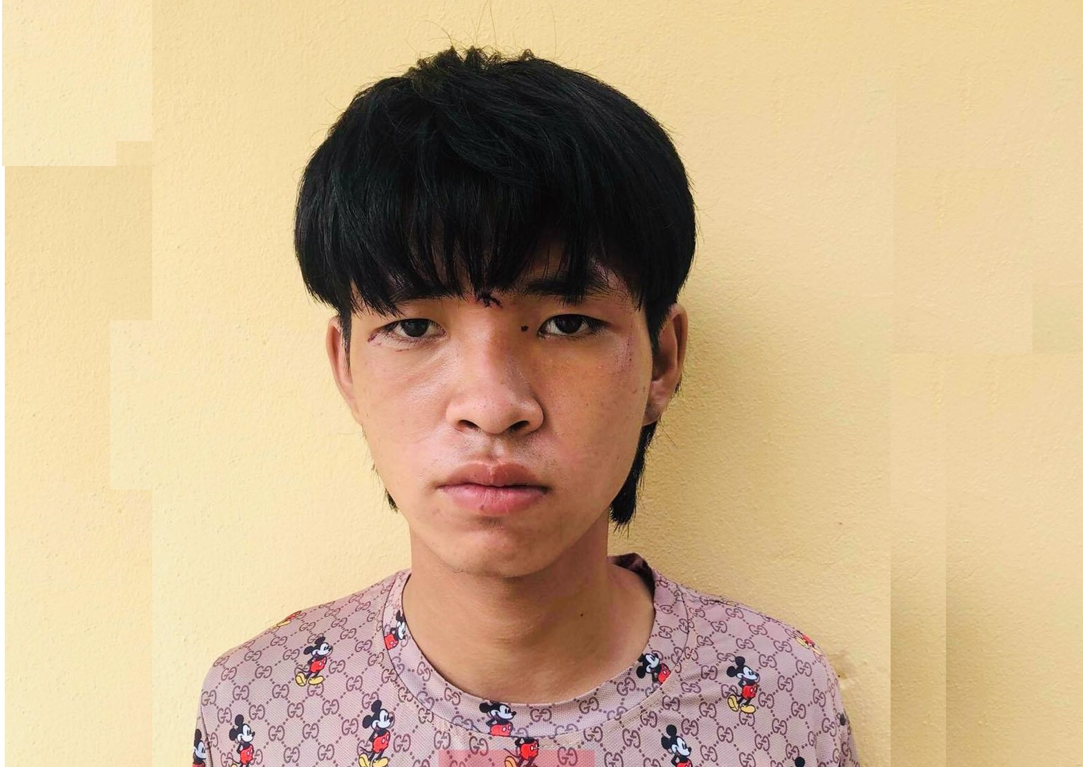 Tạm giữ hình sự đối tượng thông chốt đâm trọng thương cán bộ công an