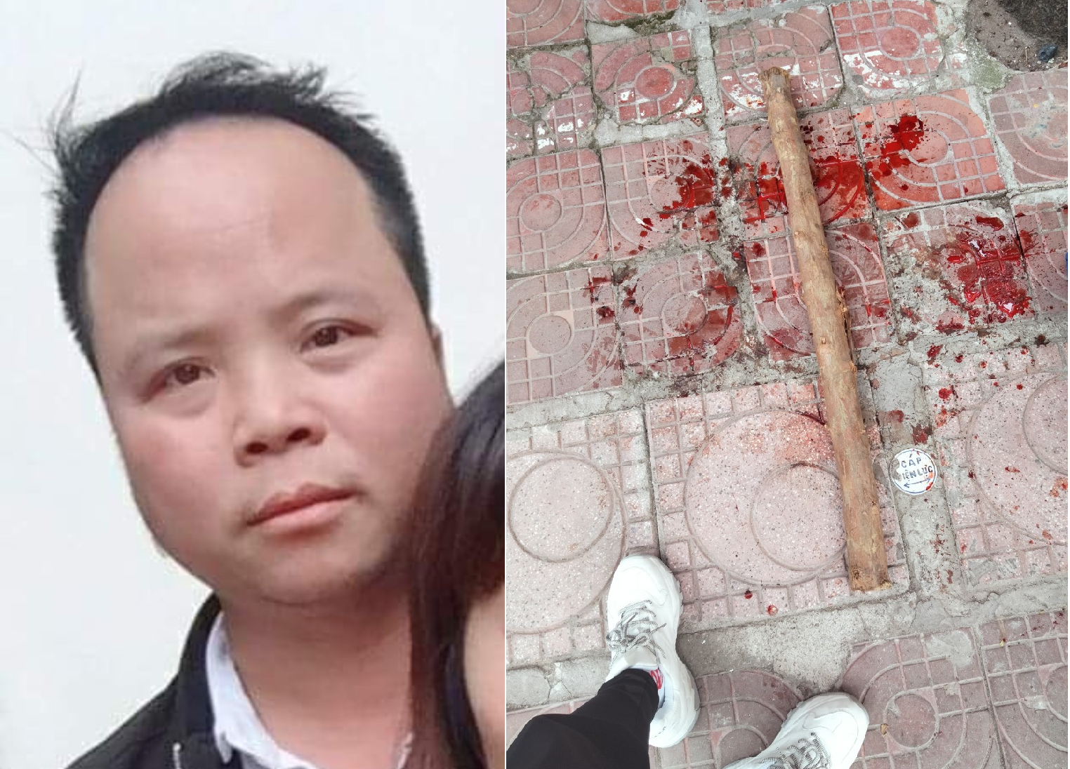 Khởi tố bị can đánh gãy chân, chấn thương sọ não tình địch