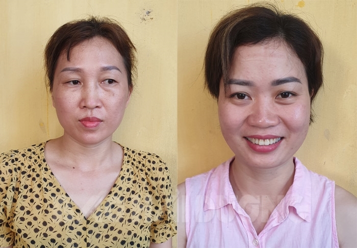 Sử dụng Giấy ra viện giả nhằm trục lợi quỹ bảo hiểm xã hội