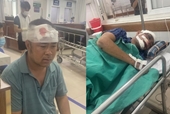 Xua đuổi quặng tặc, 5 công nhân mỏ vàng ở Lào Cai bị đánh trọng thương