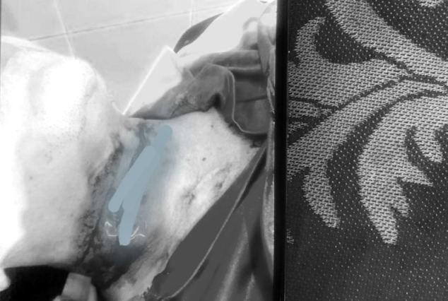 Đến dự sinh nhật, dùng dao cắt cổ bạn nhậu do mâu thuẫn tiền bạc