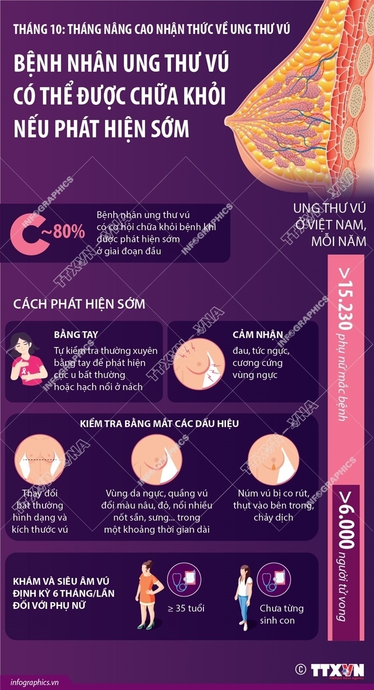 ảnh slide