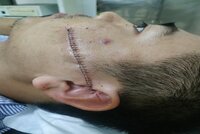 Khởi tố đối tượng giải quyết nợ  bằng dao