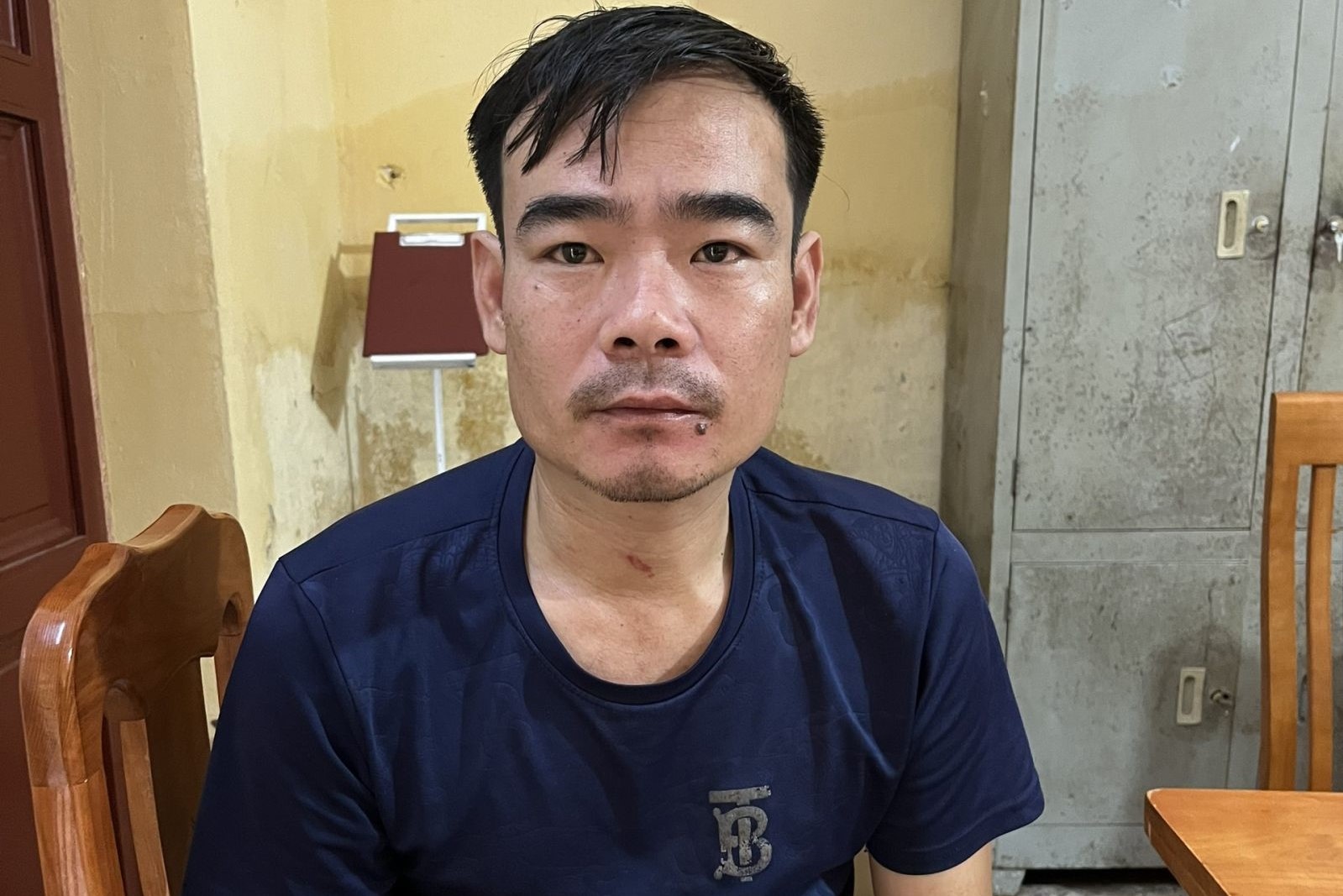 Phê chuẩn khởi tố đối tượng đấm vào mặt Công an xã