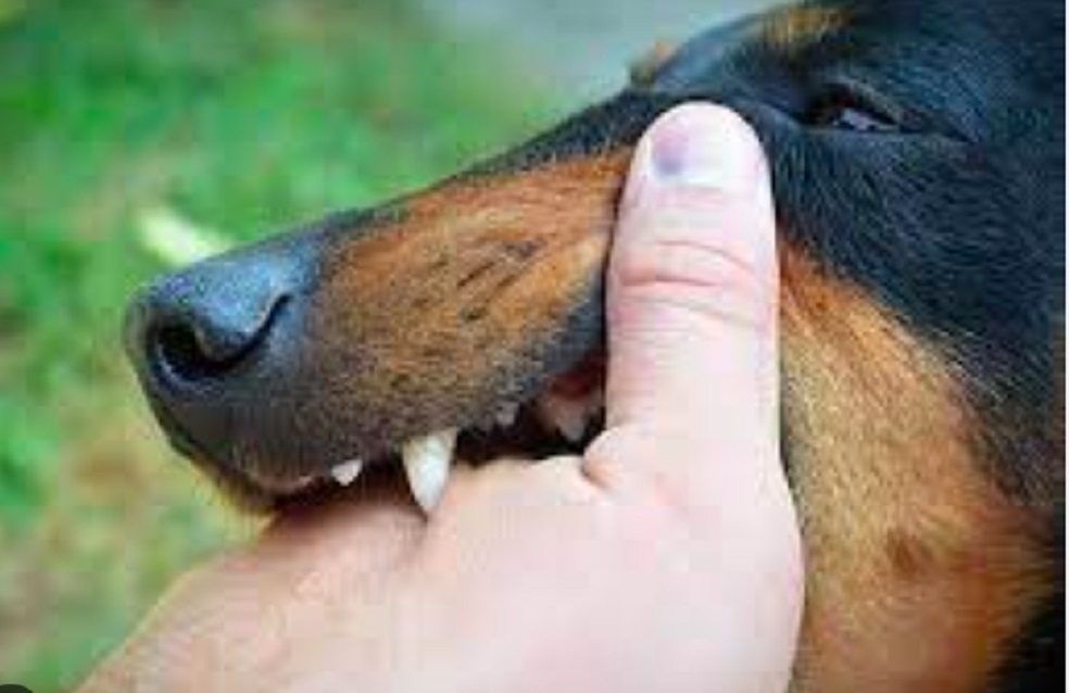 Cụ bà 78 tuổi tử vong sau 5 tháng bị chó cắn