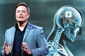 Công ty Neuralink của tỉ phú Elon Musk được phép cấy ghép não người
