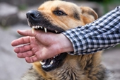 Chó nuôi phát dại cắn liên tiếp 6 người và hàng loạt con chó khác