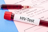 Cục Phòng, chống HIV AIDS yêu cầu làm rõ nhóm “Bông hồng đen” tự lấy máu học sinh xét nghiệm