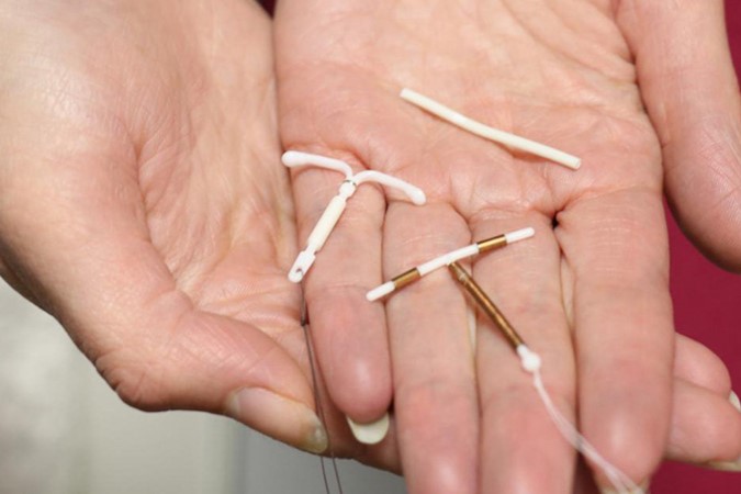 Người phụ nữ bị thủng tử cung và ruột non do “bỏ quên” vòng tránh thai suốt 30 năm