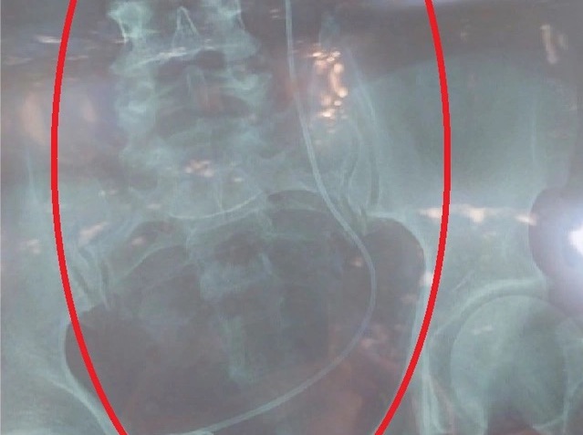 Bộ Y tế chỉ đạo khẩn về sự cố y khoa ở Lâm Đồng