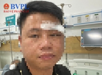 Một Luật sư tại Đà Nẵng bị hành hung bầm mắt, khâu 5 mũi trên mặt