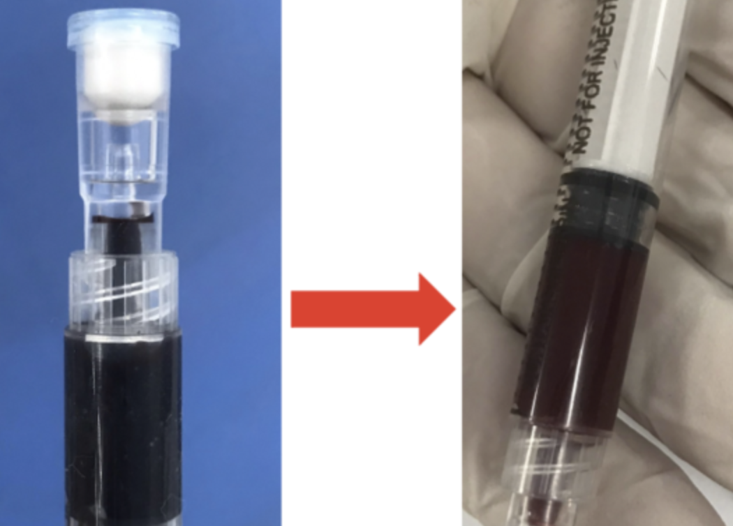 Bệnh viện chia sẻ thuốc hiếm, kịp thời cứu sống nhiều bệnh nhân bị ngộ độc nặng