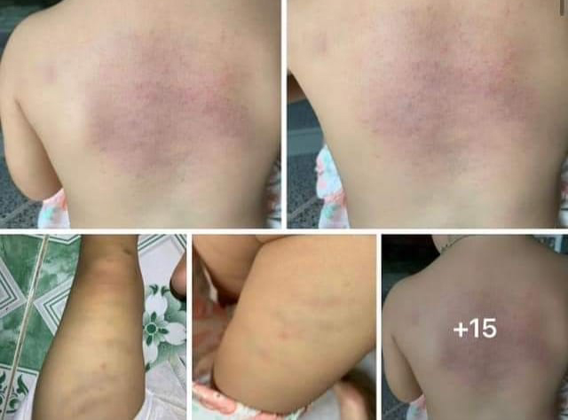 Xác minh thông tin bảo mẫu có dấu hiệu bạo hành trẻ em tại một nhà trẻ tư thục