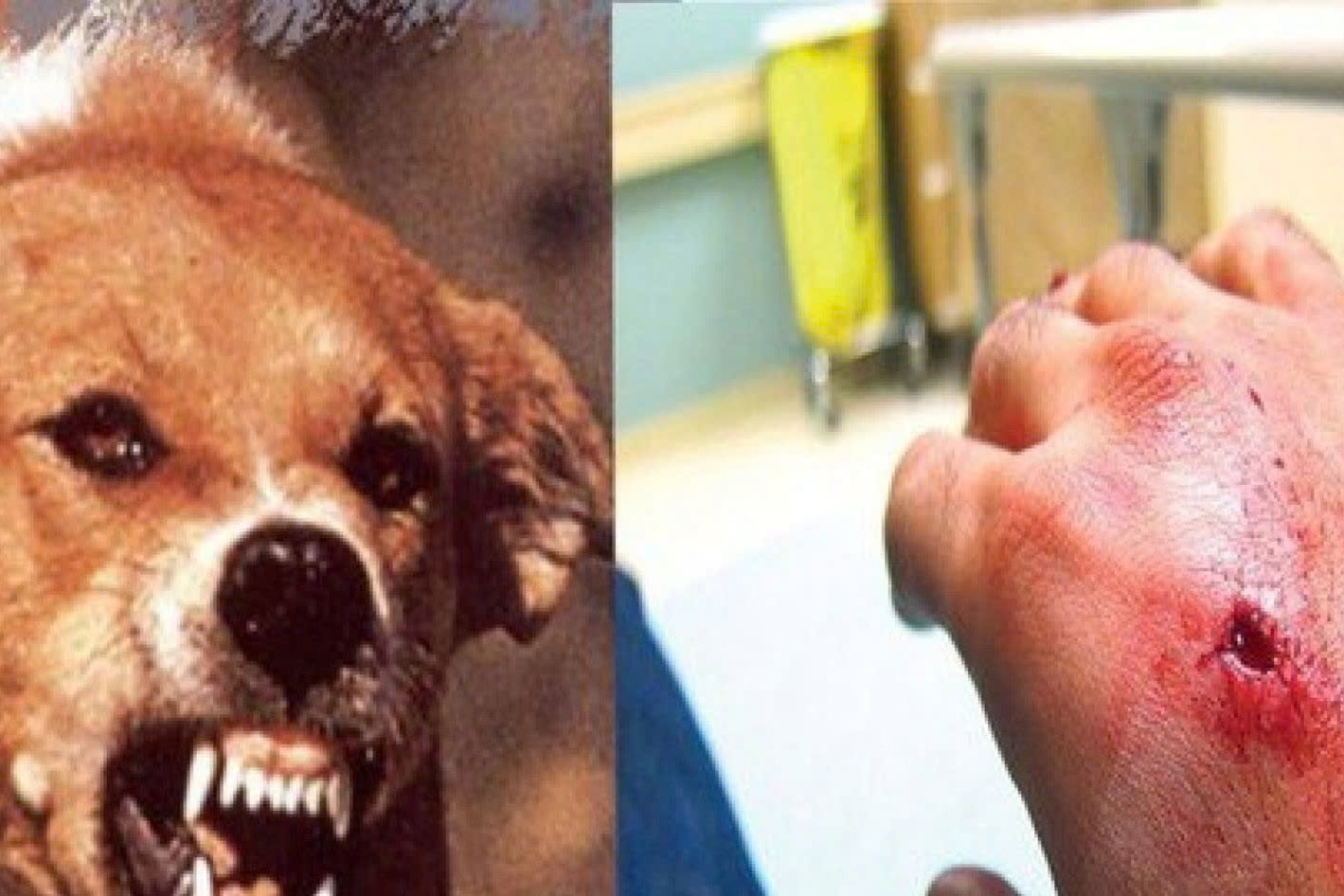 Cụ bà gần 90 tuổi nghi bị chó dại cắn tử vong