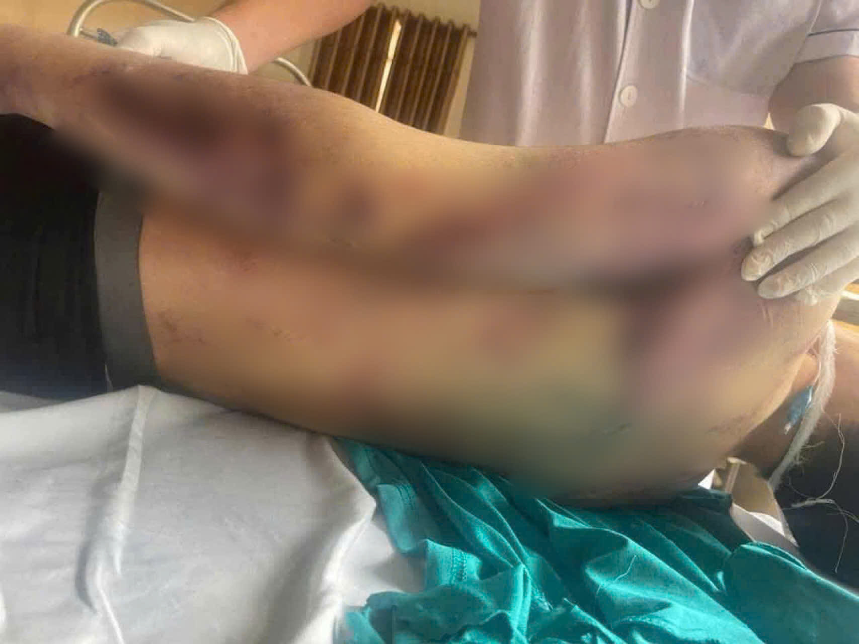 Tạm đình chỉ Trung tâm Công tác xã hội Hải Hà để điều tra vụ học viên tử vong